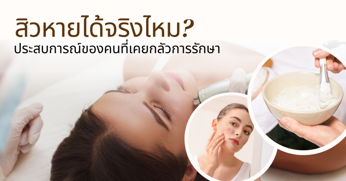 คลินิกรักษาสิวเชียงใหม่ รีวิว